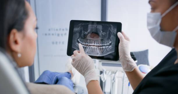 Licensed Dental Implants service in James Island, SC - Smile Center Dentistry