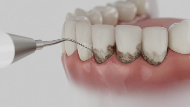 Reliable Dental Implants contractor in James Island, SC by Smile Center Dentistry